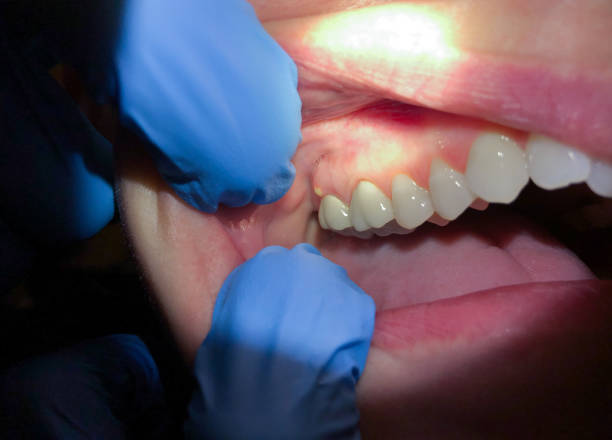 Best Emergency Dental Services for Seniors in Wilderness Rim, WA