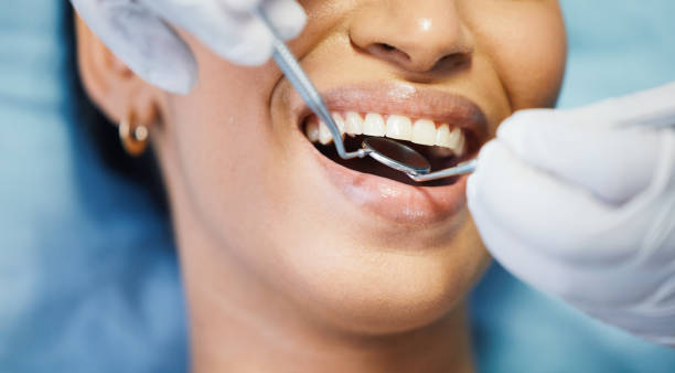 Best Emergency Root Canal Treatment in Wilderness Rim, WA